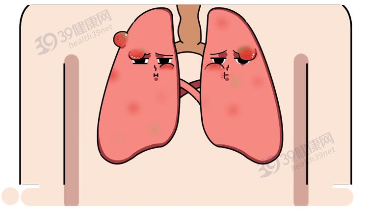 风寒、风热感冒分不清？一文教你区别，原来以前学的都错了  -图2