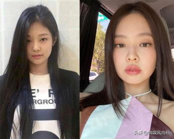 BLACKPINK Jennie：眼皮和皮肤改变了，她整容了吗？  -图3